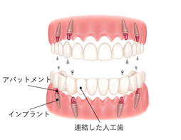 �I�[���I���S�C���[�W�}