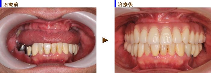 �I�[���I���S�Ǘ�P