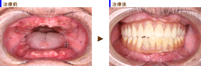 �I�[���I���S�Ǘ�Q